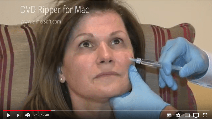 vidéo chirurgie esthétique acide hyaluronique pommettes genève