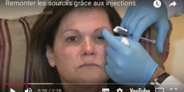 injection botox sourcils patte d'oie raspaldo genève