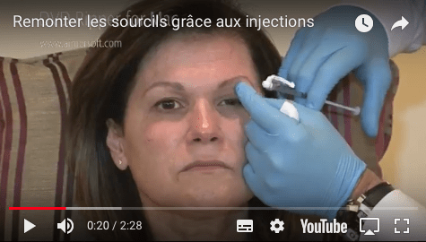 injection botox sourcils patte d'oie raspaldo genève