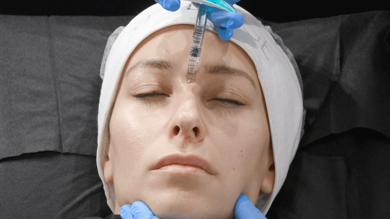 injection du dorsum lors d'une rhinoplastie médicale