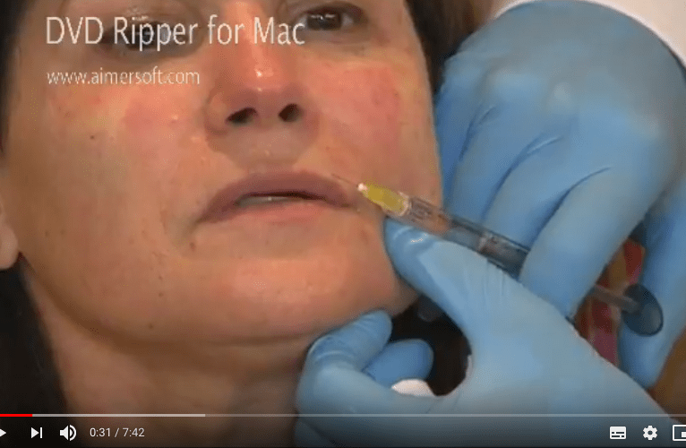 video injections lèvres acide hyaluronique