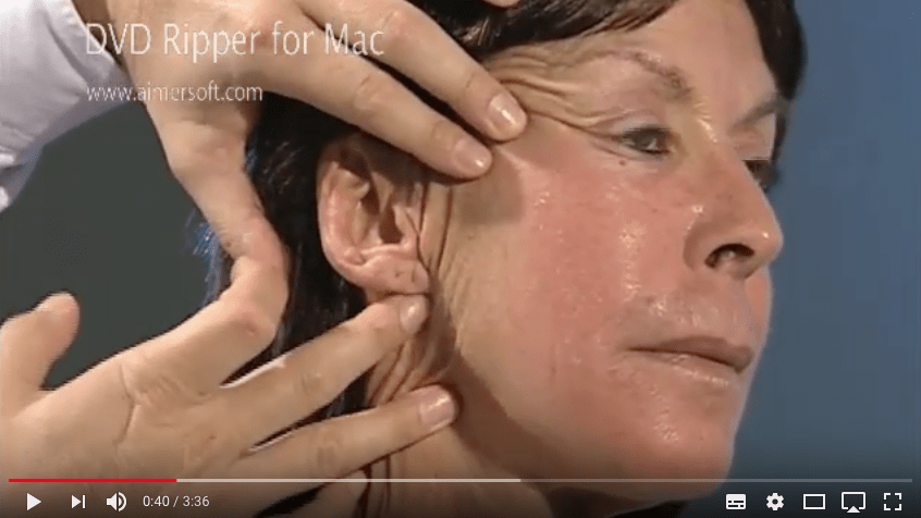 vidéo d'un lifting endoscopique pour retendre la peau